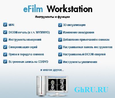 Merge eFilm Workstation 3.0 (Eng, PC) + Crack